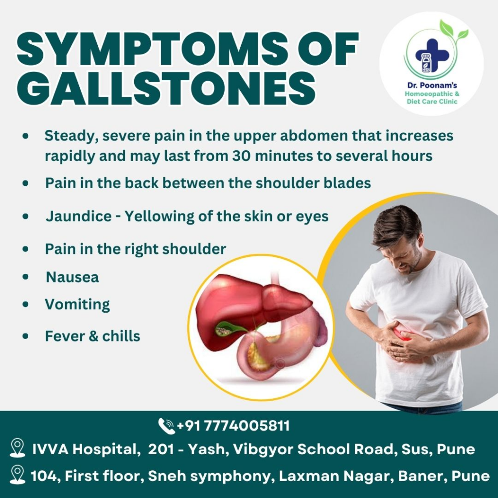 gallstones symptome and treatment 